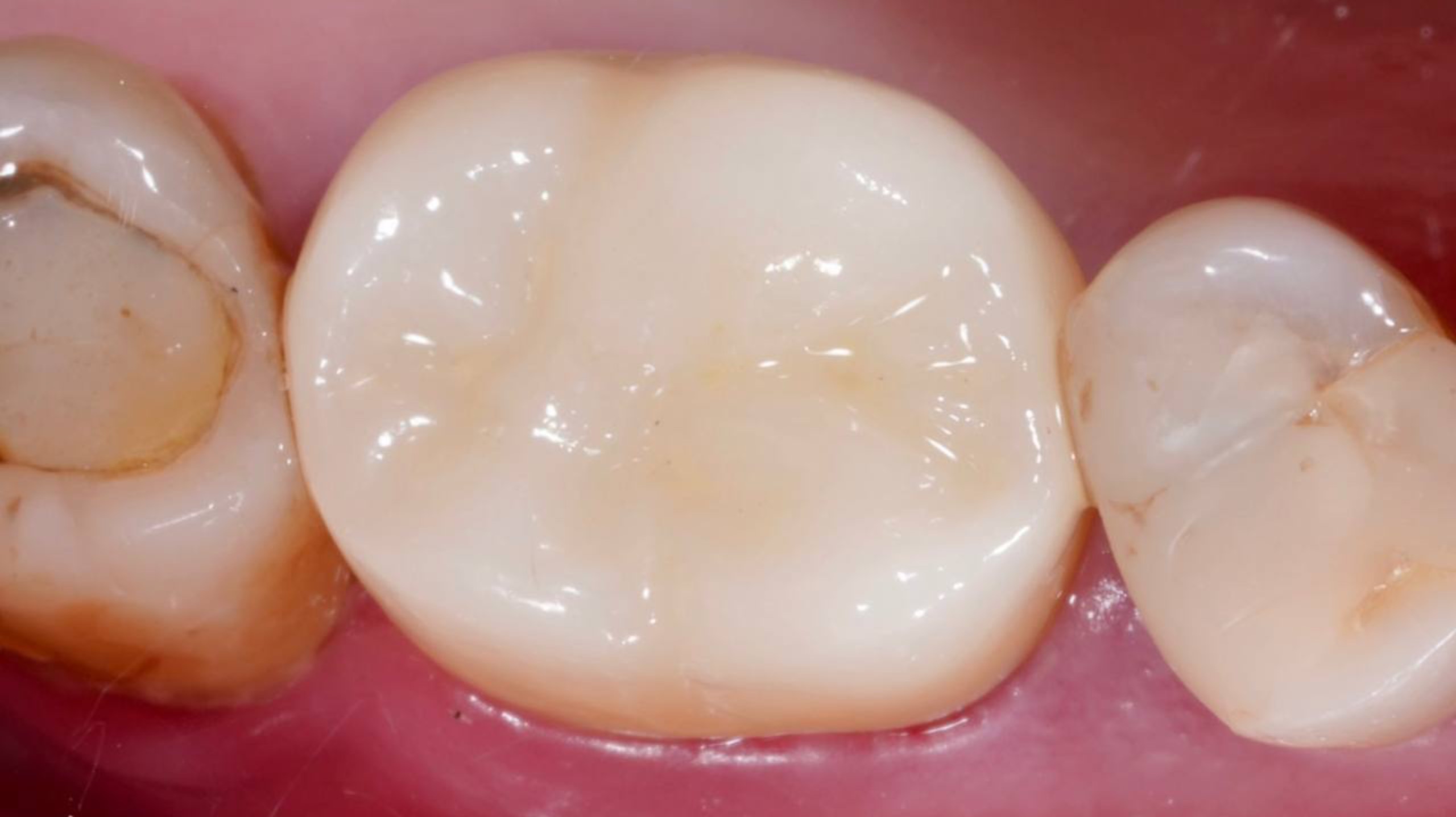 Некачественный преп - не помеха, восстановим и исправим!