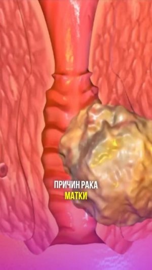 5 ошибок Женщин всех Возрастов! #shorts #бубновский #кинезитерапия