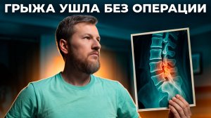 Грыжа в спине – как убрать без операции