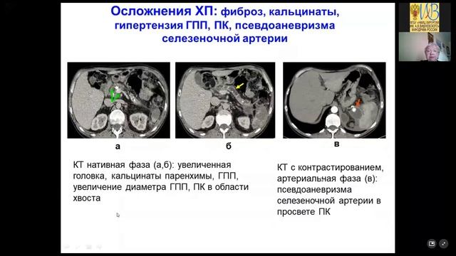 10 УЗИ и эластография смотреть онлайн