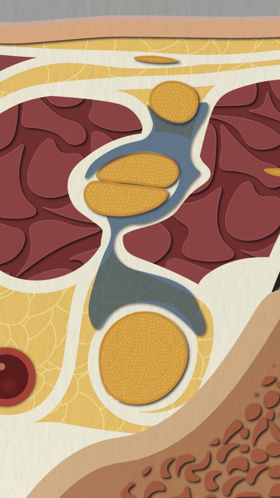 Межлестничная блокада плечевого сплетения под УЗИ | Экспертный разбор: анатомия, техника, риски смотреть онлайн