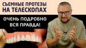 Показываем съемные зубные протезы Кандулор на телескопах, а так же процесс их установки пациенту.