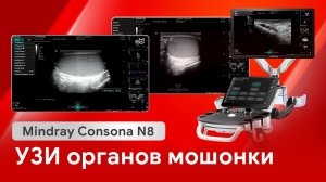 УЗИ мошонки: мастер-класс на Mindray Consona N8