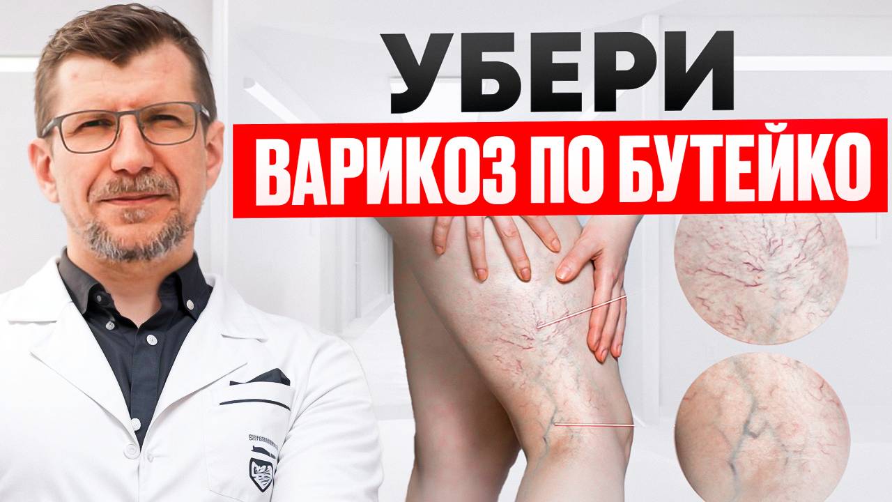 Как устранить варикоз и геморрой помогает метод Бутейко. смотреть онлайн
