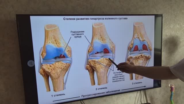 Как избежать артритов и артрозов и уберечь свои суставы. Обучение Мануальной терапии у Олега Гудвина смотреть онлайн