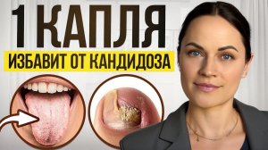 КАНДИДОЗ разрушает изнутри! Как вовремя распознать и остановить