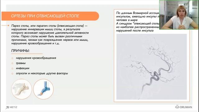 ORLIMAN для голеностопного сустава  Часть 2 (вебинар 2025)