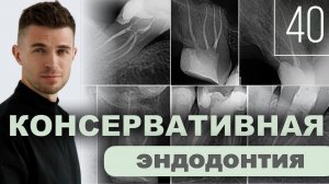Консервативная эндодонтия