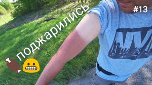 13. Сжёг руки до пузырей 😁 Барабинск!