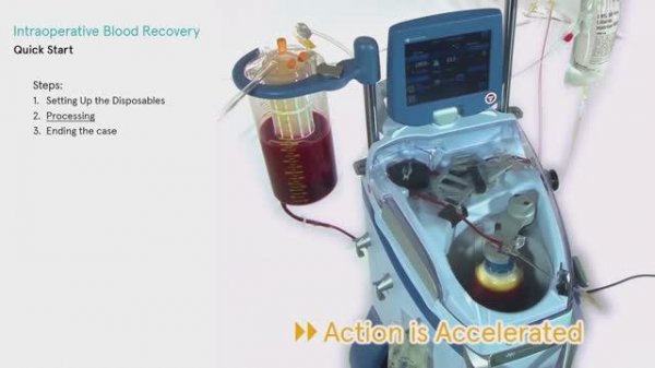 XTRA: быстрый старт