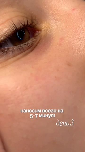 Конец вас удивит 😳пилинг от акне Cosmeya:WW150990 на ВБ