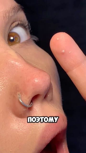 Я их просто ненавижу🩸😳 арт вб гель от акне Cosmeya:WW152221