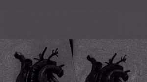 👁️Наверно ты меня не помнишь x Лезгинка😍#РОМАНИ_ЭЛИТА🥭