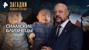 Сиамские близнецы — Загадки человечества с Олегом Шишкиным (08.10.2025)