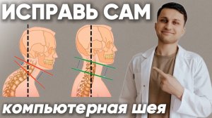 Лучшие упражнения от компьютерной шеи. Комплекс упражнений для исправления осанки