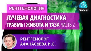 Рентгенолог Афанасьева И.С.: Лучевая диагностика травмы живота и таза. Часть 2