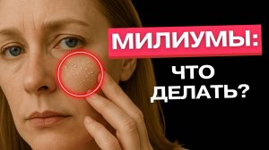 Милиумы: причина, о которой вы не знали | Милиумы под глазами: откуда и как убрать?