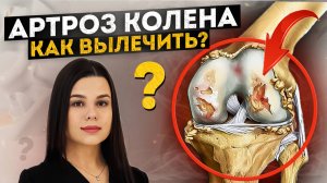 Артроз можно вылечить? Самый полный список рекомендаций! Лечение, упражнения, мифы. Остеоартроз