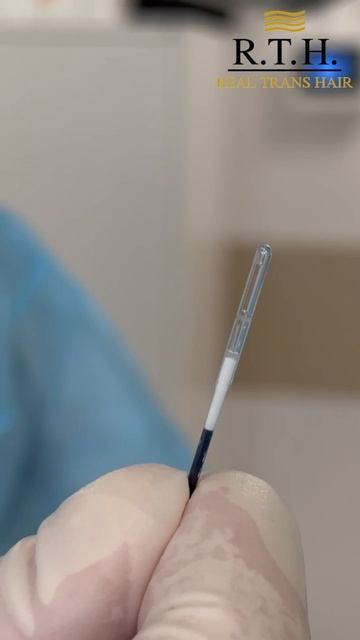 Сенсация в флебологии! Раскрываем секрет идеального лечения вен. смотреть онлайн