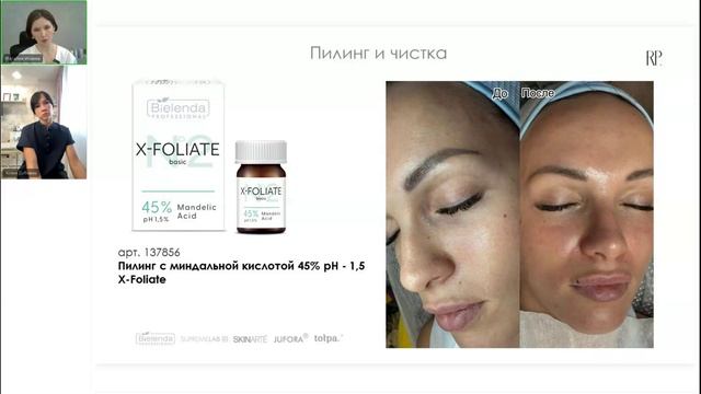 Курсы процедур: как совместить пилинги , инъекции, ретинол