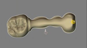 Моделирование в BlenderForDenal: Балка + зуб