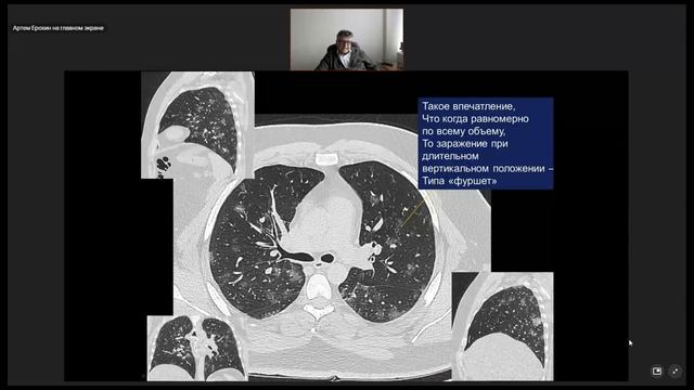 14 Рентген ОГК + COVID-19 смотреть онлайн