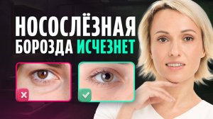 После ЭТИХ приемов НОСОСЛЕЗНАЯ БОРОЗДА исчезнет / Как убрать впадины под глазами без ФИЛЛЕРОВ
