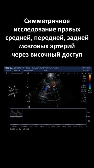 Транскраниальное скнарование артерий основания мозга (online-video-cutter.com)