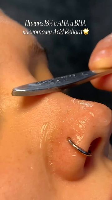 я выиграла💁🏼♀️🤑пилинг от акне Cosmeya:WW150990 на ВБ