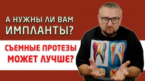 Устанавливаем пациенту условно-съемные протезы All-on-6 (все на 6 имплантах)!