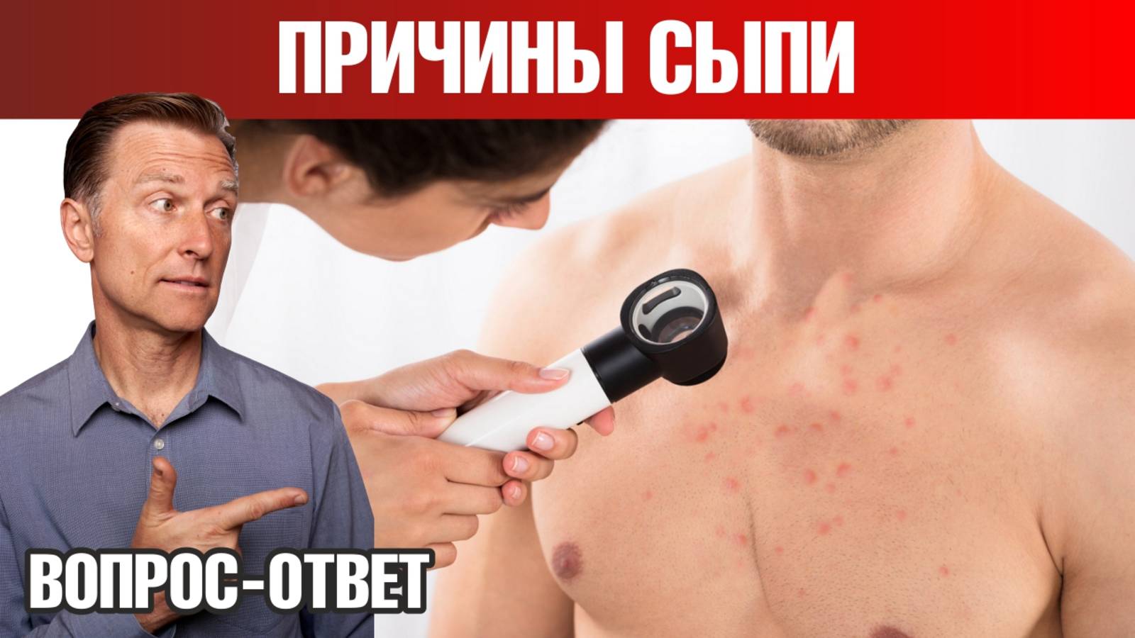 Сыпь на коже: причины и решение проблемы🙌 смотреть онлайн
