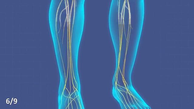 7 железных причин есть чернослив каждый день (вот это эффект) смотреть онлайн