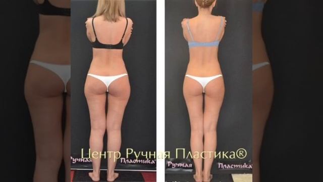 Коррекция фигуры. Ручная Пластика тела,  целлюлит. 30 лет практики. Патент  Ruchnaya-plastika.ru
