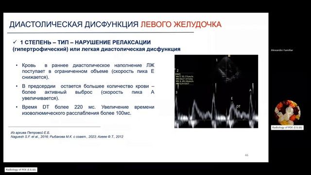 18 ЭхоКГ смотреть онлайн