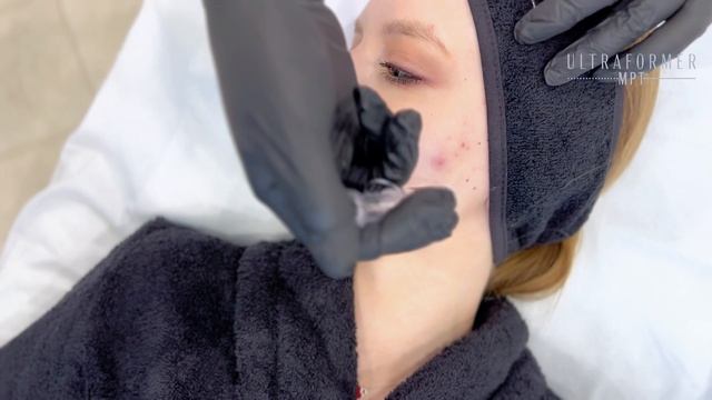 SMAS-лифтинг Екб смотреть онлайн