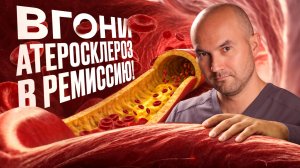 Атеросклероз, что делать? Хирург о том, что реально помогает!