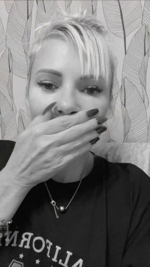 желтые зубы 😱