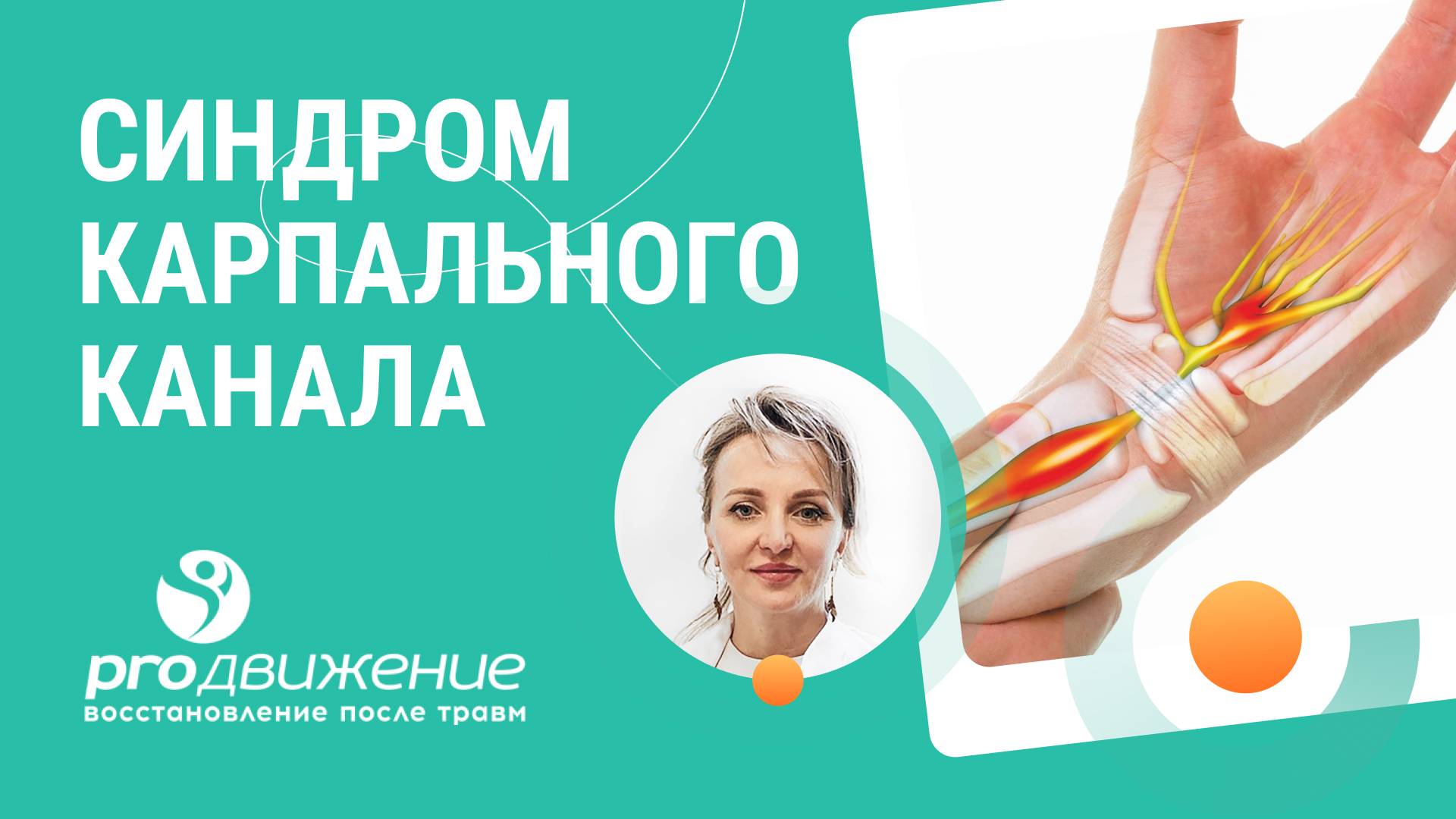 👉 Что делать когда немеют пальцы. Синдром карпального канала