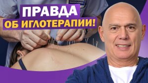 Иглотерапия — правда и мифы! Как её используют в кинезитерапии