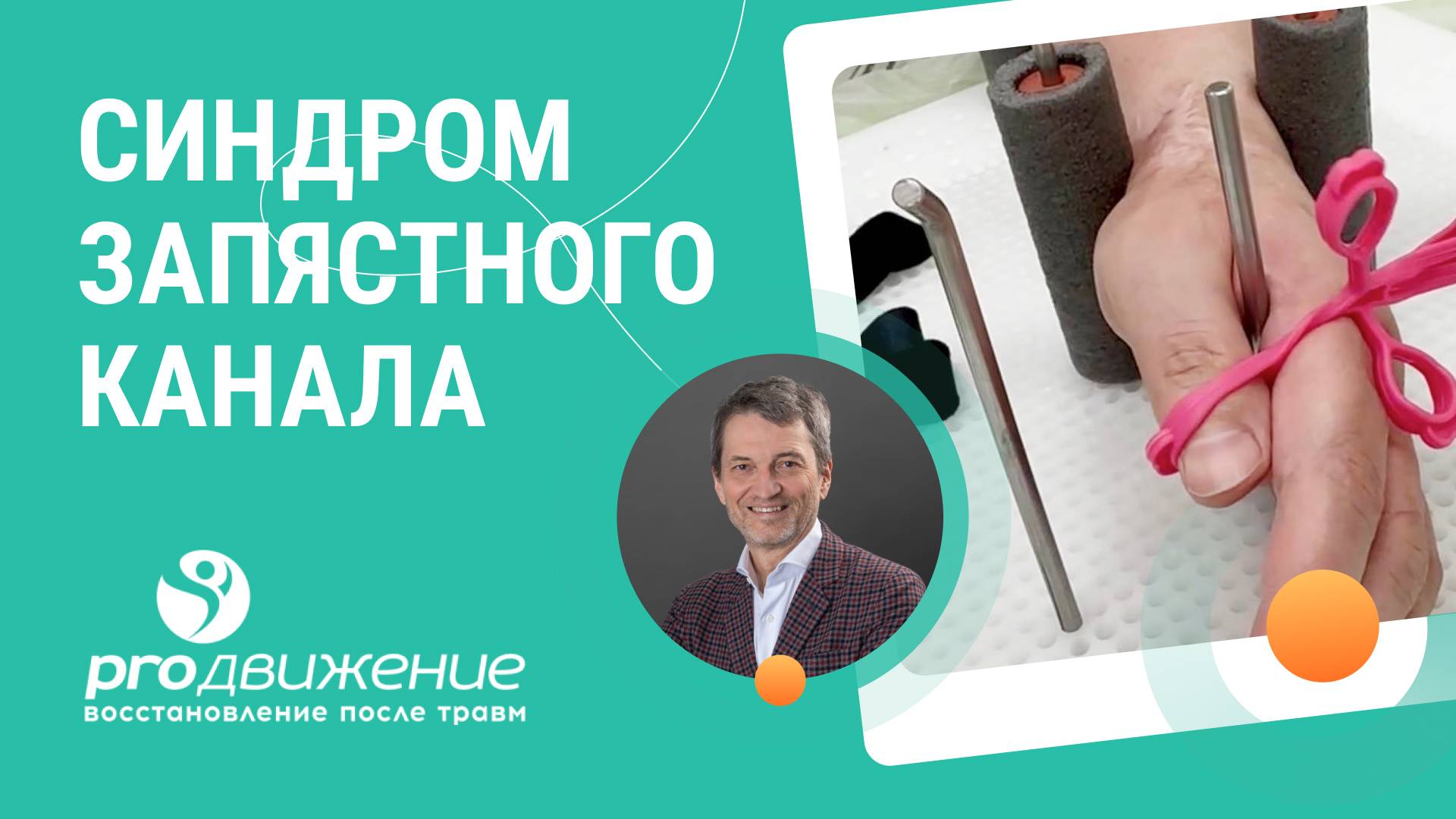 🤏  Синдром запястного канала