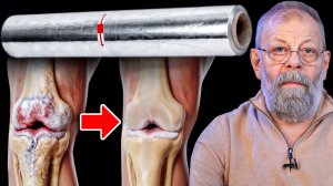 💡 Натуральный обезбол для коленей за 100 ₽ из хоз.магазина