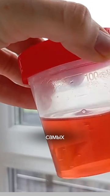 Самый важный анализ во время беременности смотреть онлайн