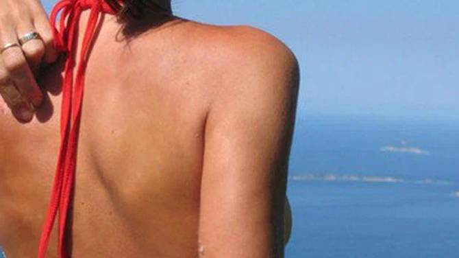 Как избавиться от прыщей на руках смотреть онлайн