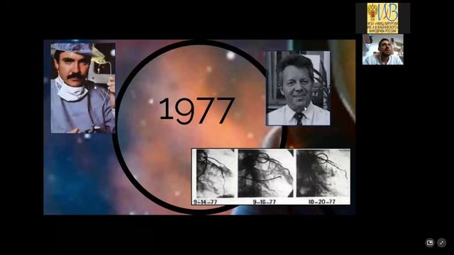 19 ЭхоКГ Часть 2 И Эндоваскулярная кардиохирургия смотреть онлайн