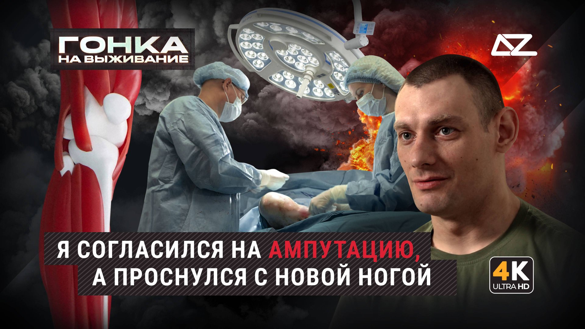 Гонка на выживание. На СВОих ногах | Я согласился на ампутацию, а проснулся с новой ногой смотреть онлайн