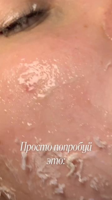 Спасение твоей кожи🤒🥶Cosmeya тоник от акне:WW152237