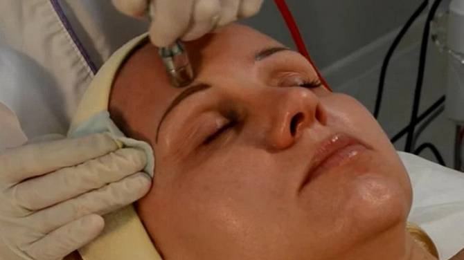 Что такое алмазная микродермабразия смотреть онлайн