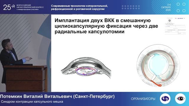 04.10 Зал Роговица Сателлитный симпозиум Солофарм Глазная коморбидность в хирургии катаракты смотреть онлайн