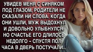 УВИДЕВ МЕНЯ С СИНЯКОМ ПОД ГЛАЗОМ, РОДИТЕЛИ НЕ СКАЗАЛИ НИ СЛОВА, ОНИ УШЛИ, МУЖ ВЫДОХНУЛ. НО ПОТОМ...