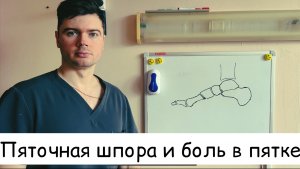 Плантарный фасциит и Пяточная шпора: полный гид по причинам, симптомам и лечению.